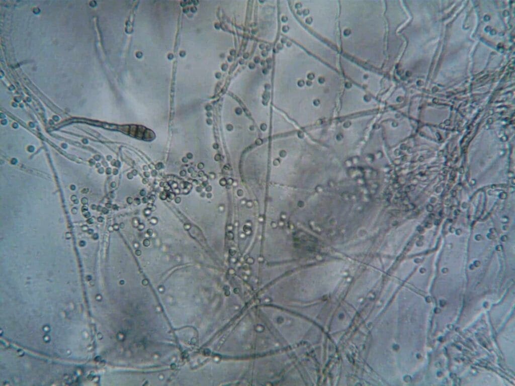 Microscopic Parasite under a Microscope. Parasite Cleanse. Natural Parasite Cleanse Autralia. Brisbane Livewell Clinic