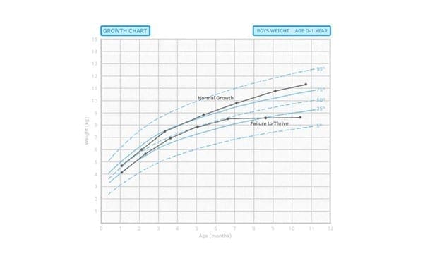 Paediatric Nutrition and Faltering Growth Source: https://doctorsaustralia.com.au/au/topic/general-report/failure-to-thrive
