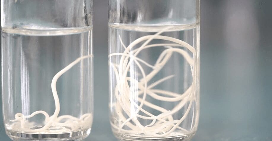 Parasites taken from the human body. Natural Parasite Cleanse Australia. Brisbane Livewell Clinic