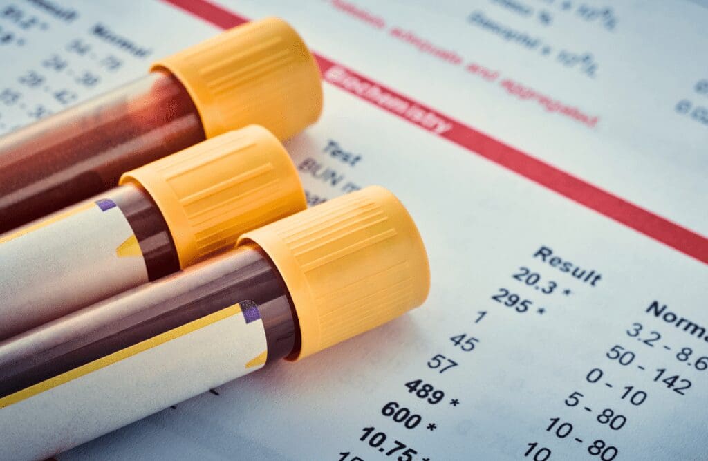 Testing results. Naturopaths. Brisbane Livewell Clinic