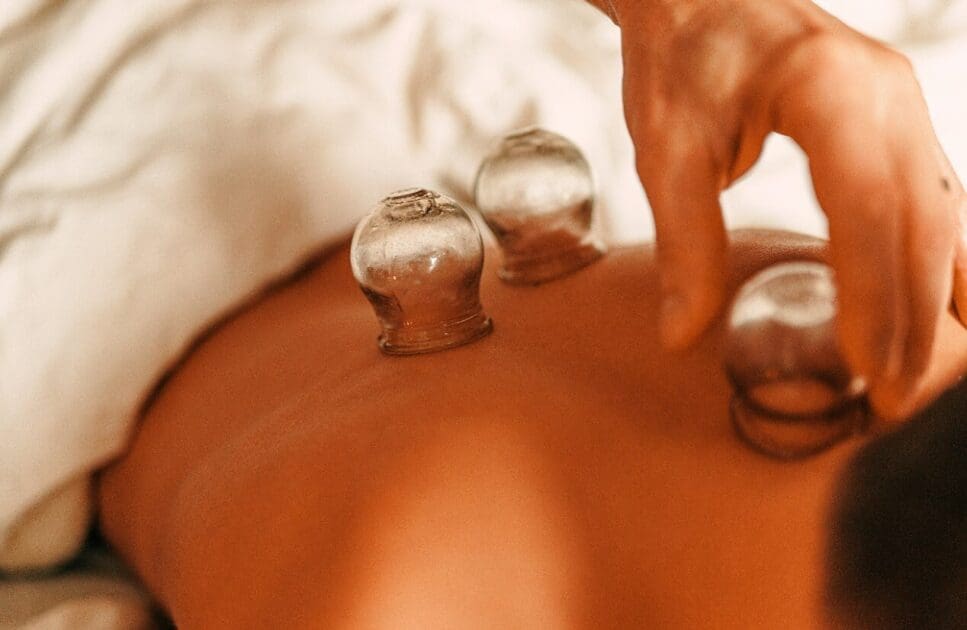 Person receiving cupping therapy. Cupping Near Me. Brisbane Livewell Clinic