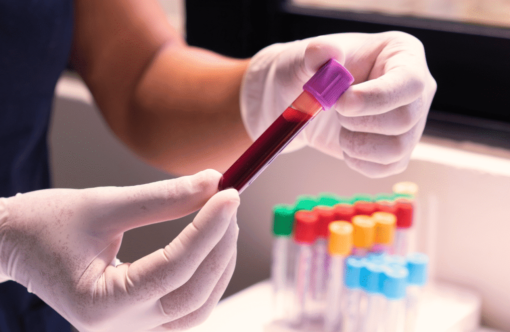 Person holding a Blood Sample in a Test Tube. How to Get Hormone Levels Checked. Brisbane Livewell Clinic